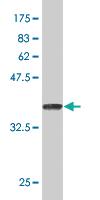 Anti-HSPB8 Mouse Monoclonal Antibody [clone: 5B12]