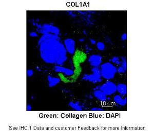 Anti-COL1A1 Rabbit Polyclonal Antibody