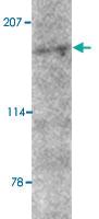 Anti-AMBRA1 Rabbit Polyclonal Antibody