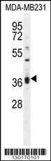 Anti-KLHL35 Rabbit Polyclonal Antibody (APC (Allophycocyanin))