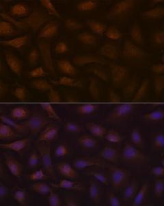 Anti-KIFAP3 Rabbit Monoclonal Antibody [clone: ARC1211]