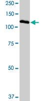 Anti-SIRT1 Rabbit Polyclonal Antibody