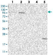 Anti-OGT Rabbit Polyclonal Antibody