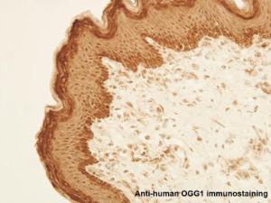 Anti-OGG1 Rabbit Polyclonal Antibody (DyLight 650)