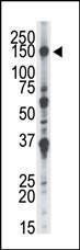 Anti-NEK1 Rabbit Polyclonal Antibody (Biotin)