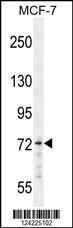 Anti-MED25 Rabbit Polyclonal Antibody (AP (Alkaline Phosphatase))