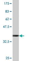 Anti-EIF4ENIF1 Mouse Monoclonal Antibody [clone: 2C4]