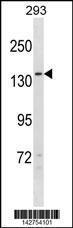 Anti-NPC1L1 Rabbit Polyclonal Antibody (Biotin)