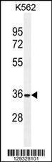 Anti-FOXI3 Rabbit Polyclonal Antibody