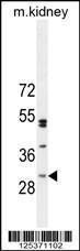 Anti-CF062 Rabbit Polyclonal Antibody (FITC (Fluorescein Isothiocyanate))