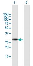 Anti-IGFBP4 Mouse Polyclonal Antibody