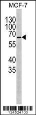 Anti-COXI Rabbit Polyclonal Antibody (AP (Alkaline Phosphatase))