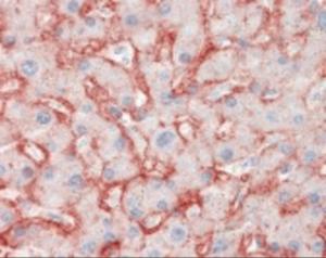 Immunohistochemistry staining of SLC2A2 in liver tissue using SLC2A2 Monoclonal Antibody.