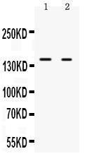 Anti-NRIP1 Rabbit Polyclonal Antibody