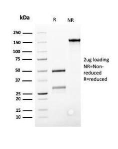 SDS-PAGE analysis of Anti-Bcl-2 Antibody [SPM117] under non-reduced and reduced conditions; showing intact IgG and intact heavy and light chains, respectively. SDS-PAGE analysis confirms the integrity and purity of the antibody