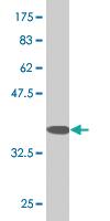 Anti-RHOG Mouse Monoclonal Antibody [clone: 2E6]