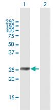 Anti-IGFBP6 Mouse Polyclonal Antibody