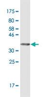 Anti-TLR5 Mouse Monoclonal Antibody [clone: 4G5]