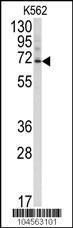 Anti-UBQLN3 Rabbit Polyclonal Antibody (AP (Alkaline Phosphatase))