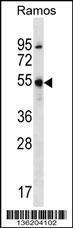 Anti-FOXJ2 Rabbit Polyclonal Antibody (FITC (Fluorescein Isothiocyanate))