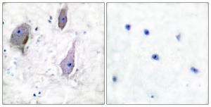 Anti-PMP22 Rabbit Polyclonal Antibody