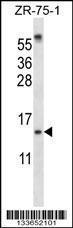 Anti-SUMO1 Rabbit Polyclonal Antibody (AP (Alkaline Phosphatase))