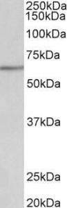 Anti-AKT2 Antibody (A84096) (0.3 µg/ml) staining of Human Skeletal Muscle lysate (35 µg protein in RIPA buffer). Primary incubation was 1 hour. Detected by chemiluminescence