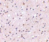 Anti-CADPS Rabbit Polyclonal Antibody