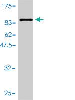 Anti-ALDH4A1 Mouse Polyclonal Antibody