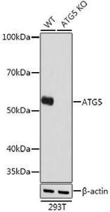 Anti-APG5L/ATG5 Rabbit Monoclonal Antibody [clone: ARC0156]