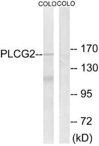 Western blot analysis of lysates from COLO205 cells using Anti-PLCG2 Antibody. The right hand lane represents a negative control, where the antibody is blocked by the immunising peptide