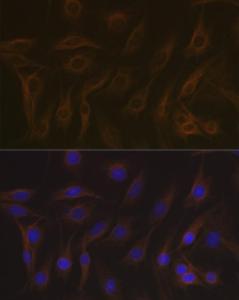 Anti-EB3 antibody