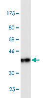 Anti-CEACAM6 Mouse Monoclonal Antibody [clone: 1G2]