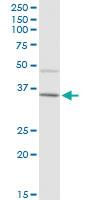 Anti-IGHA2 Mouse Polyclonal Antibody