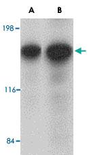 Anti-CADPS Rabbit Polyclonal Antibody