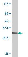 Anti-GNL3 Mouse Monoclonal Antibody [clone: 1A1]