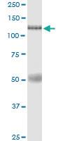 Anti-EIF4ENIF1 Polyclonal Antibody Pair