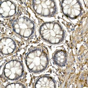 Immunohistochemistry analysis of paraffin-embedded human colon tissue using Anti-Neurogenin3 / NGN-3 Antibody (A11561) at a dilution of 1:200 (40x lens)