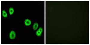 Immunofluorescence analysis of HUVEC cells using Anti-GPR18 Antibody. The right hand panel represents a negative control, where the antibody was pre-incubated with the immunising peptide