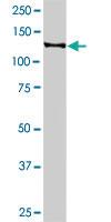 Anti-SIRT1 Rabbit Polyclonal Antibody