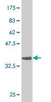 Anti-GNL3 Mouse Monoclonal Antibody [clone: 3A3]