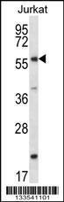 Anti-FOXJ3 Rabbit Polyclonal Antibody (Biotin)