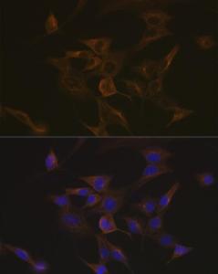 Anti-EB3 antibody