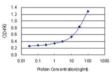 Anti-ALDH4A1 Polyclonal Antibody Pair