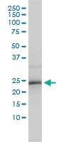 Anti-RNF114 Mouse Monoclonal Antibody [clone: 4G3-1A10]