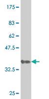 Anti-GNL3 Mouse Monoclonal Antibody [clone: 4B10]