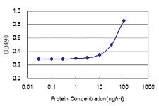 Anti-HMBS Antibody Pair