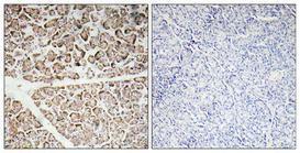 Immunohistochemical analysis of paraffin-embedded human pancreas using Anti-IGF-I Antibody 1:100 (4°C overnight). The right hand panel represents a negative control, where the antibody was pre-incubated with the immunising peptide.