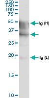 Anti-PRMT6 Rabbit Polyclonal Antibody