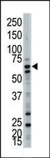 Anti-UBQLN3 Rabbit Polyclonal Antibody (Biotin)